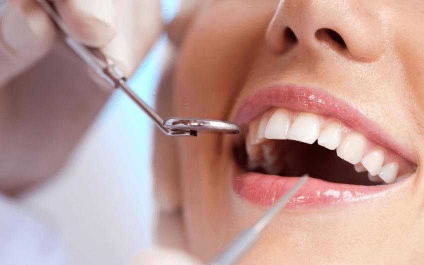 teeth cleaning dentist