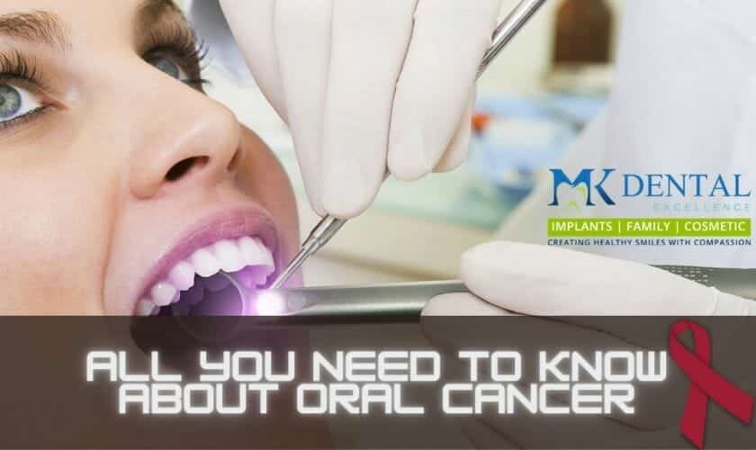 oral cancer screening in Cincinnati