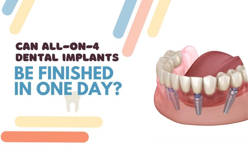 all-on-4 implants dentist