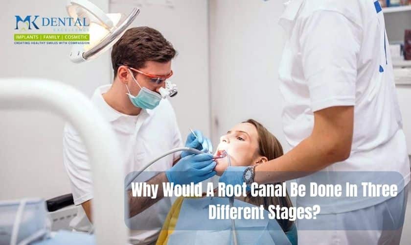 Root Canal Treatment