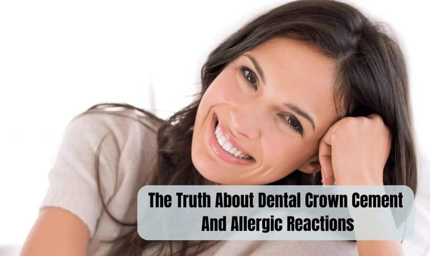 Dental Crown Cement And Allergic Reactions
