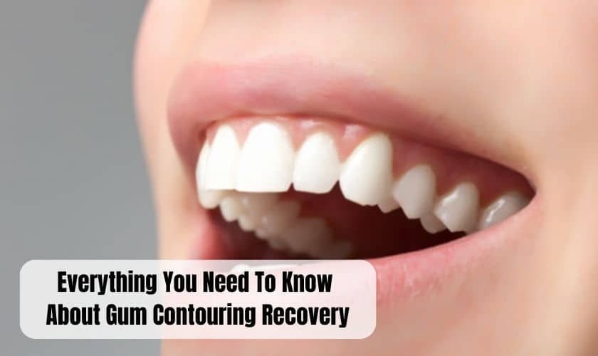 Gum Contouring Recovery in Cincinnati