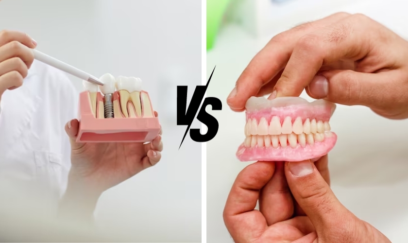 dental implants vs dentures which option is right for you cincinnati - mk dental excellence reply