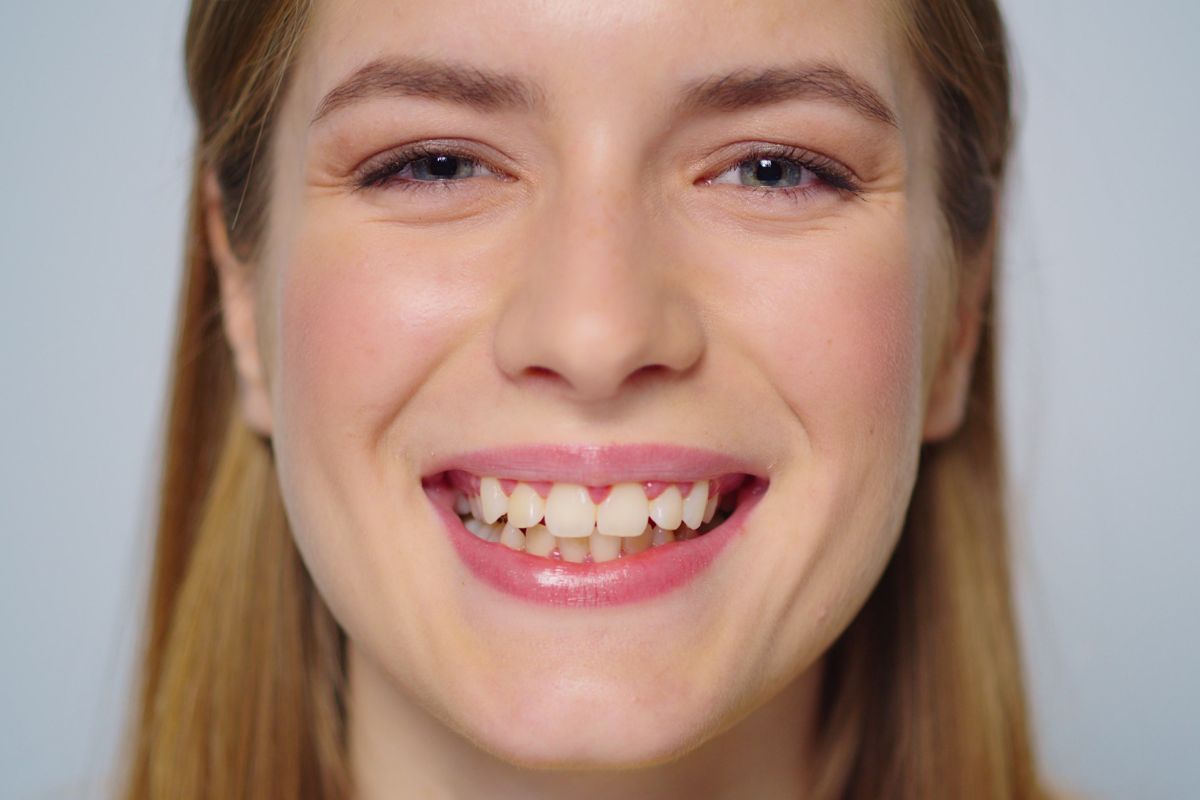 People Judge Your Smile in 7 Seconds — Here’s What They Notice First