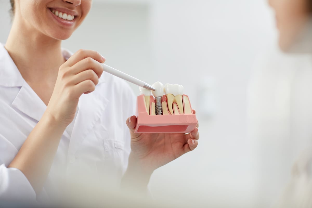 Dental Implants in Cincinnati