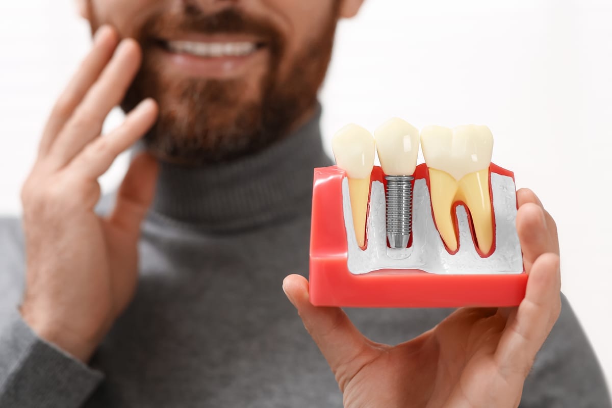 Dental Implants in Rossmoyne